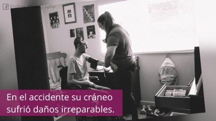 A este hombre le falta la mitad del cráneo, descubre el motivo...