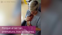 ¡Su bebé nació prematuro y por primera vez lo puede coger en brazos!