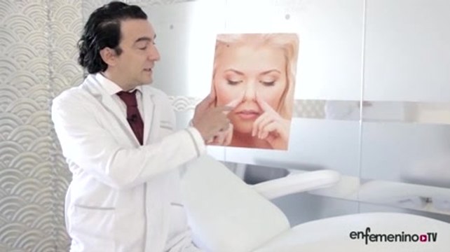 Qué es y Cómo se Hace una Rinoplastia