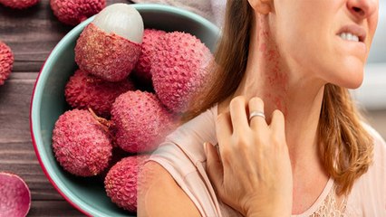 इस बीमारी से पीड़ित लोग भूलकर भी ना खाएं Litchi, हो सकता है खतरनाक | Boldsky