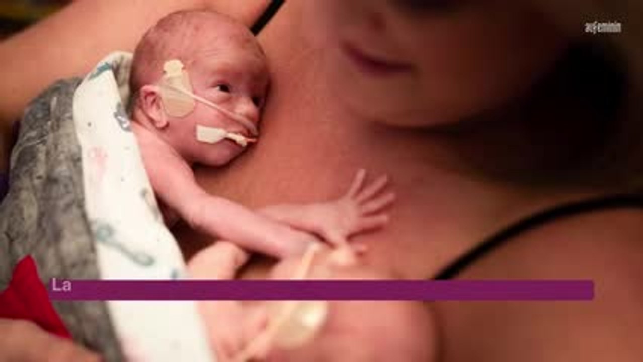 Bébé prématuré : qu’est-ce que la prématurité