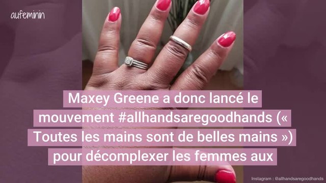 Elle lance un mouvement pour décomplexer les femmes qui ont les doigts potelés