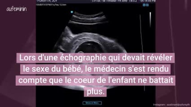 Après une fausse couche, cette star de la télé réalité publie des photos de son bébé décédé