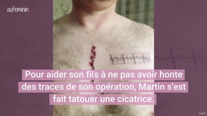 Ce papa se fait tatouer la même cicatrice que son petit garçon opéré du coeur