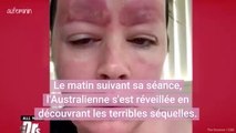 Victime d'une grosse infection après un microblading