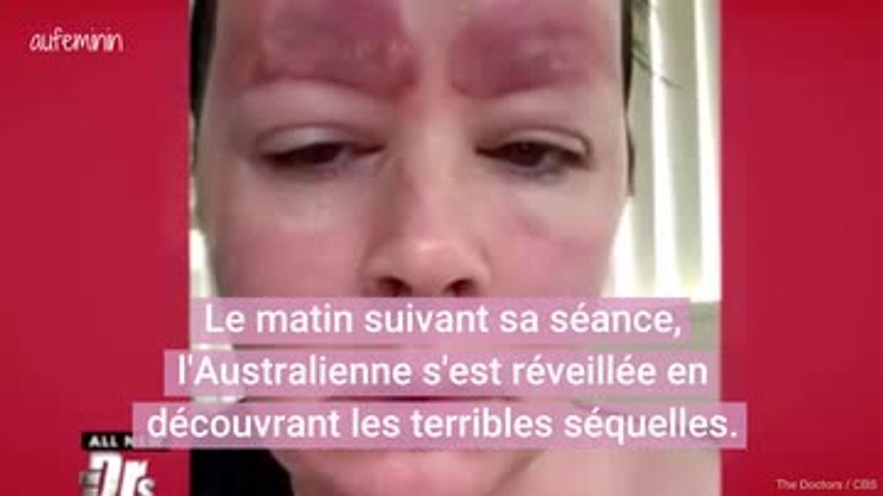 Victime d'une grosse infection après un microblading