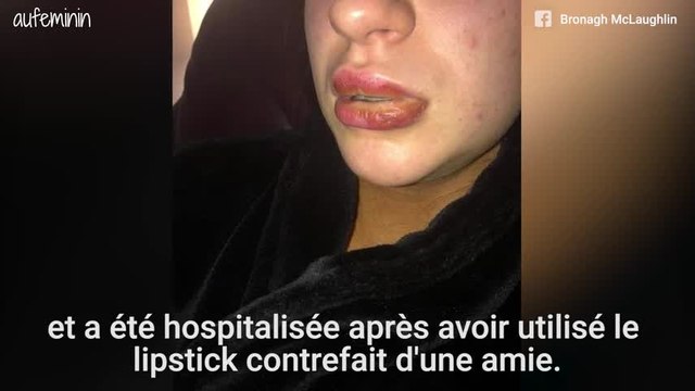Après avoir utilisé un rouge à lèvres de contrefaçon, sa bouche s'infecte