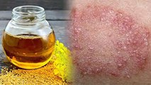 Mustard Oil से क्या ठीक हो सकता है Fungal Infection ? | सरसों के तेल के फायदे | Boldsky