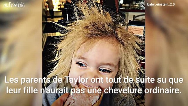 Atteinte du syndrome des cheveux incoiffables, cette fillette fascine la Toile