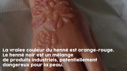 Attention ! Cette petite fille s'est fait tatouer au "hénné" mais au b