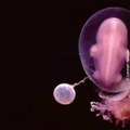 L'impressionnant développement d'un foetus en 22 photos superbes.