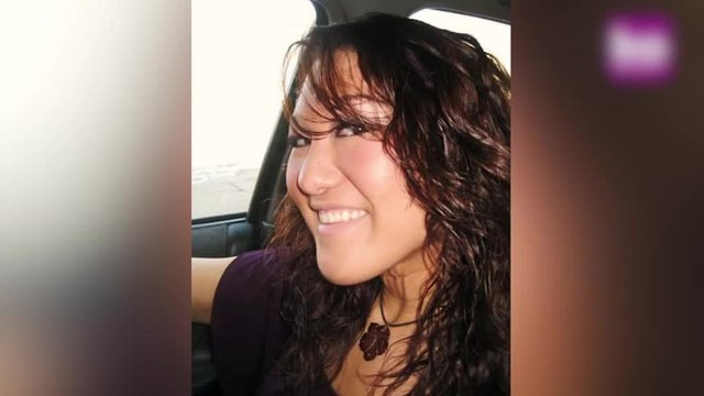 Atteinte d'une maladie de peau, elle devient mannequin