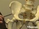 Problèmes de hanches : causes et prothèses de hanches - Alexis Nogier