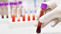 New Cancer-Detecting Blood Test Is Accurate Enough To Be Rolled Out, Study Suggests