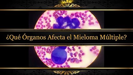 ¿Qué Órganos Afecta el Mieloma Múltiple