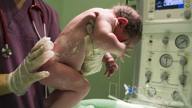 Embarazadas con covid y en Uci: incremento de maternas en cuidado intensivo preocupa en Colombia