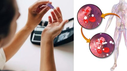 Diabetes Patient में Hyperglycemia का खतरा, Symptoms को ना करें नजरअंदाज | Boldsky