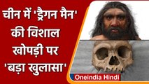 China में Dragon Man की विशाल खोपड़ी पर बड़ा खुलासा, जानिए इसके बारे में | वनइंडिया हिंदी