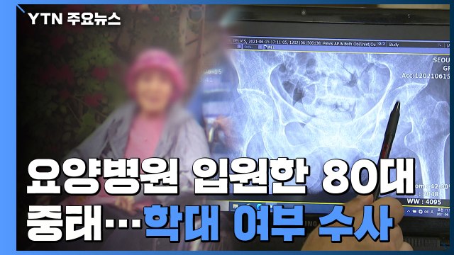 [제보는Y] 요양병원 입원한 80대 3주 만에 중태...학대 여부 수사 / YTN
