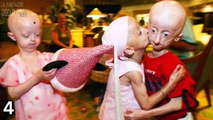Las 6 Anomalías Genéticas Más Horrorosas Del Mundo