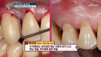 치아 건강 고수 전해주는 올바른 치아 관리법 TV CHOSUN 20210627 방송