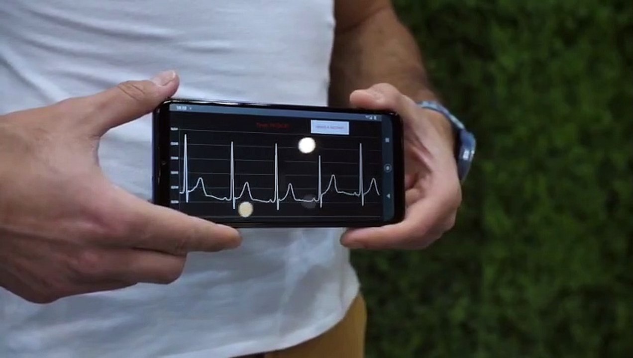 ZTE YouCare, así es la camiseta con 5G que monitoriza la salud y salva vidas