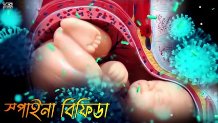 ব্রেইন ছাড়া জন্মেছিল এই ছেলেটি! ৬ বছর পর রিপোর্ট দেখে ডাক্তাররাও নির্বাক!