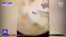 [이슈톡] 현미경으로 본 생선살…미세플라스틱 줄줄이 발견