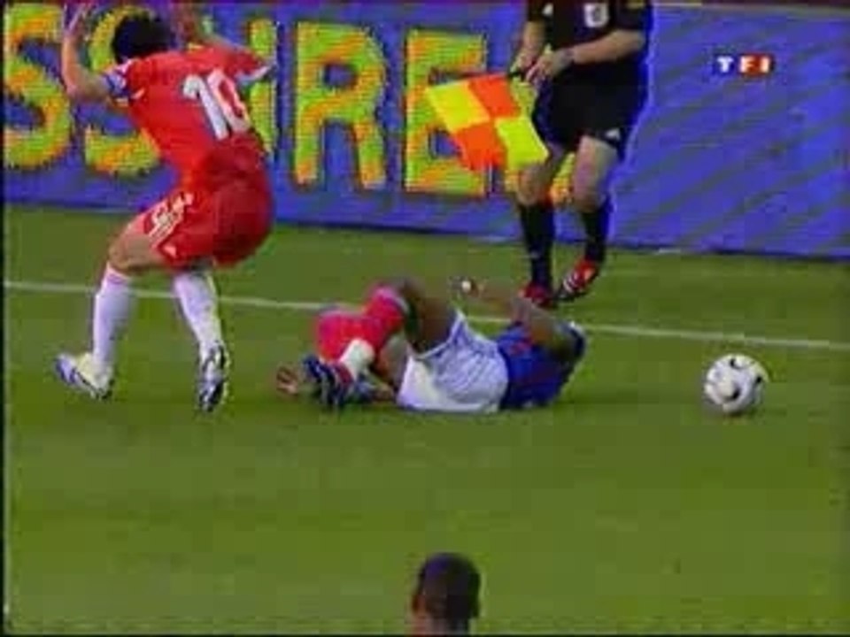 fracture cisse