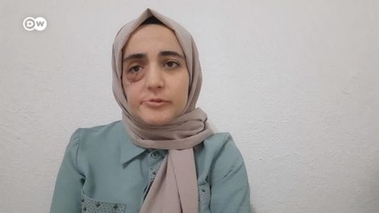 Kanser hastası hükümlü Ayşe Özdoğan: "Ölmek istemiyorum"