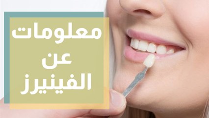 أهم المعلومات التي يجب أن تعرفها عن الفينيرز قبل اتخاذك للقرار