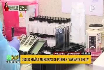 Cusco: mandan a Lima cinco muestras sospechosas de la variante Delta
