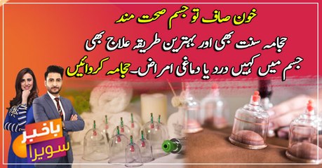 Cupping therapy (Hijama) can improve the quality of your life