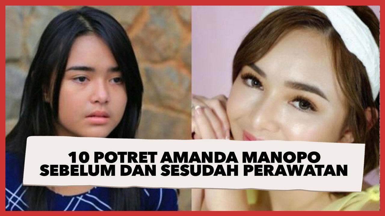 10 Potret Amanda Manopo Sebelum dan Sesudah Perawatan