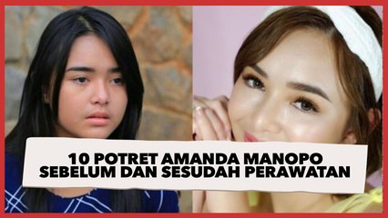 10 Potret Amanda Manopo Sebelum dan Sesudah Perawatan