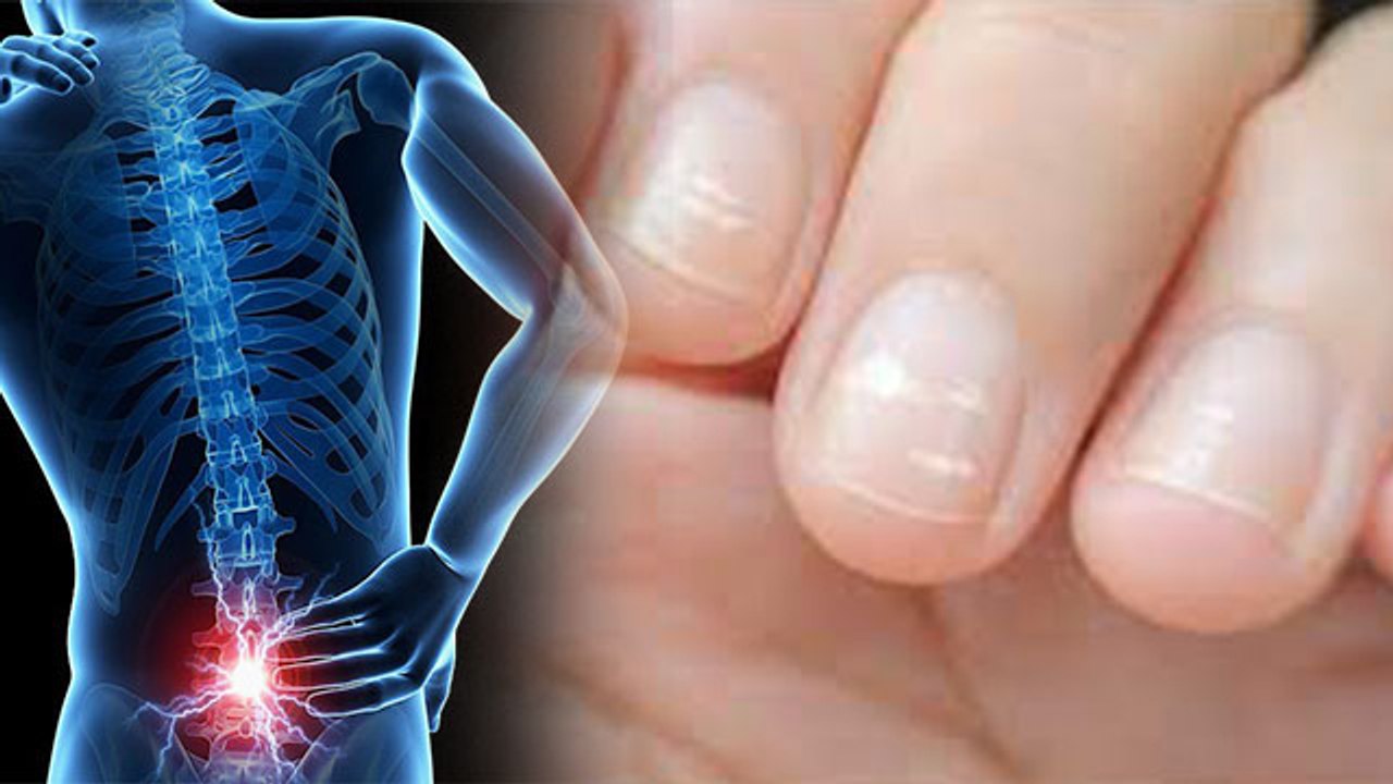 कैल्शियम की कमी के लक्षण और दूर करने का उपाय | Calcium symptoms | Boldsky