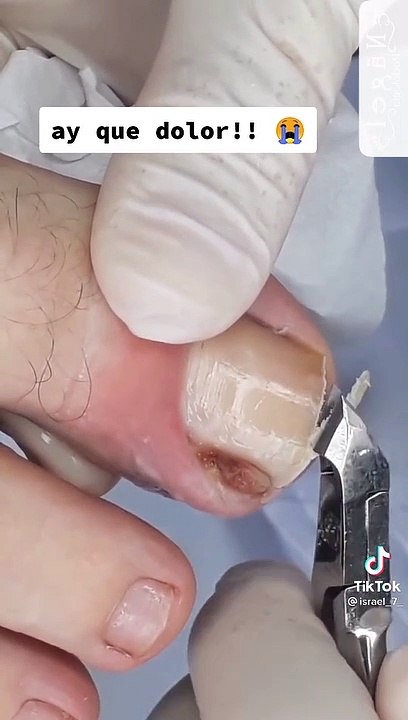 Pedicure