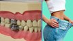 Weight Loss के लिए आई जबरदस्त Dental Slim Diet Device, कैसे चुटकियों में घटाएगी वजन | Boldsky