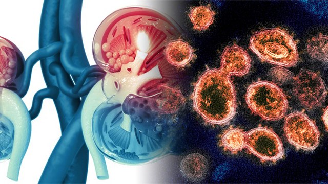 Delta Variant Covid से क्या Kidney Fail होने का खतरा, Symptoms ना करें नजरअंदाज | Boldsky