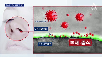 코로나 침투경로 찾았다…‘콧속 점막’에서 감염 이뤄져