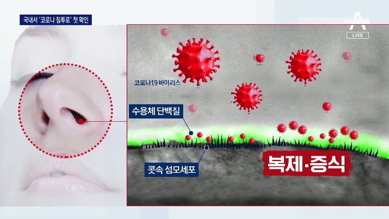 코로나 침투경로 찾았다…‘콧속 점막’에서 감염 이뤄져