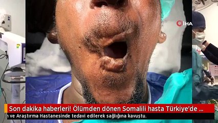 Son dakika haberleri! Ölümden dönen Somalili hasta Türkiye'de tedavi edildi