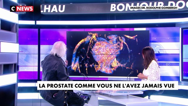 La prostate comme vous ne l'avez jamais vue en 3D et en couleurs