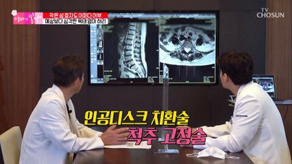 (행복) 수술 후 많이 좋아진 엄마의 상태 TV CHOSUN 20210704 방송