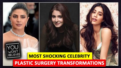 Anushka Sharma, Priyanka Chopra, Esha Gupta | Celebs Who Did Plastic Surgery