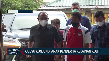 Edy Rahmayadi Kunjungi Anak Penderita Kelainan Kulit