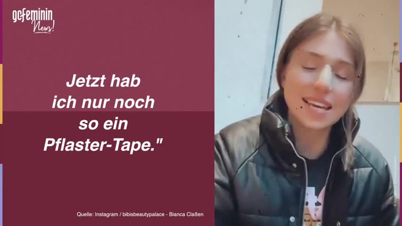 Schönheits-OP: Bibi Claßen zeigt ihre neue Nase