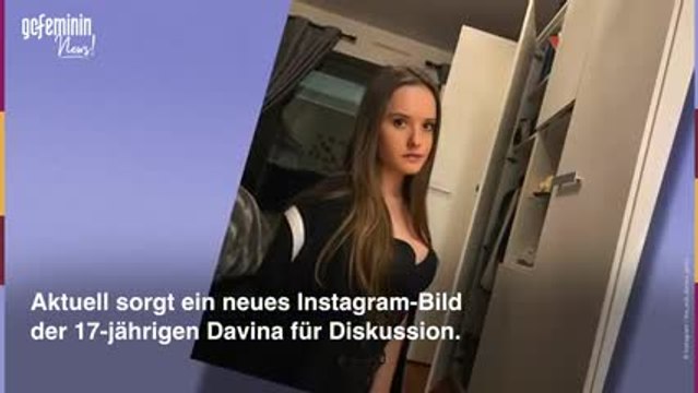 Davina Geiss: Ließ sie sich schon unters Messer legen
