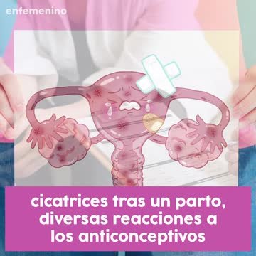 ¿Sabes qué es la dispaurenia y cómo te afecta