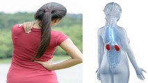 Back Pain आपका Kidney Problem का इशारा तो नहीं, Doctors Advice | Boldsky